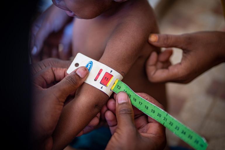 NUTRITION: Exploring causes, solutions to childhood stunting